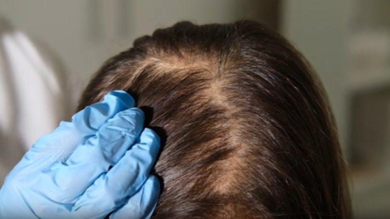 Micropigmentation in Los Angeles